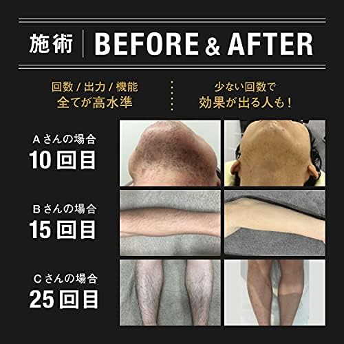 限定特典付き メンズ全身脱毛器 サロン監修 VIO対応 (黒)