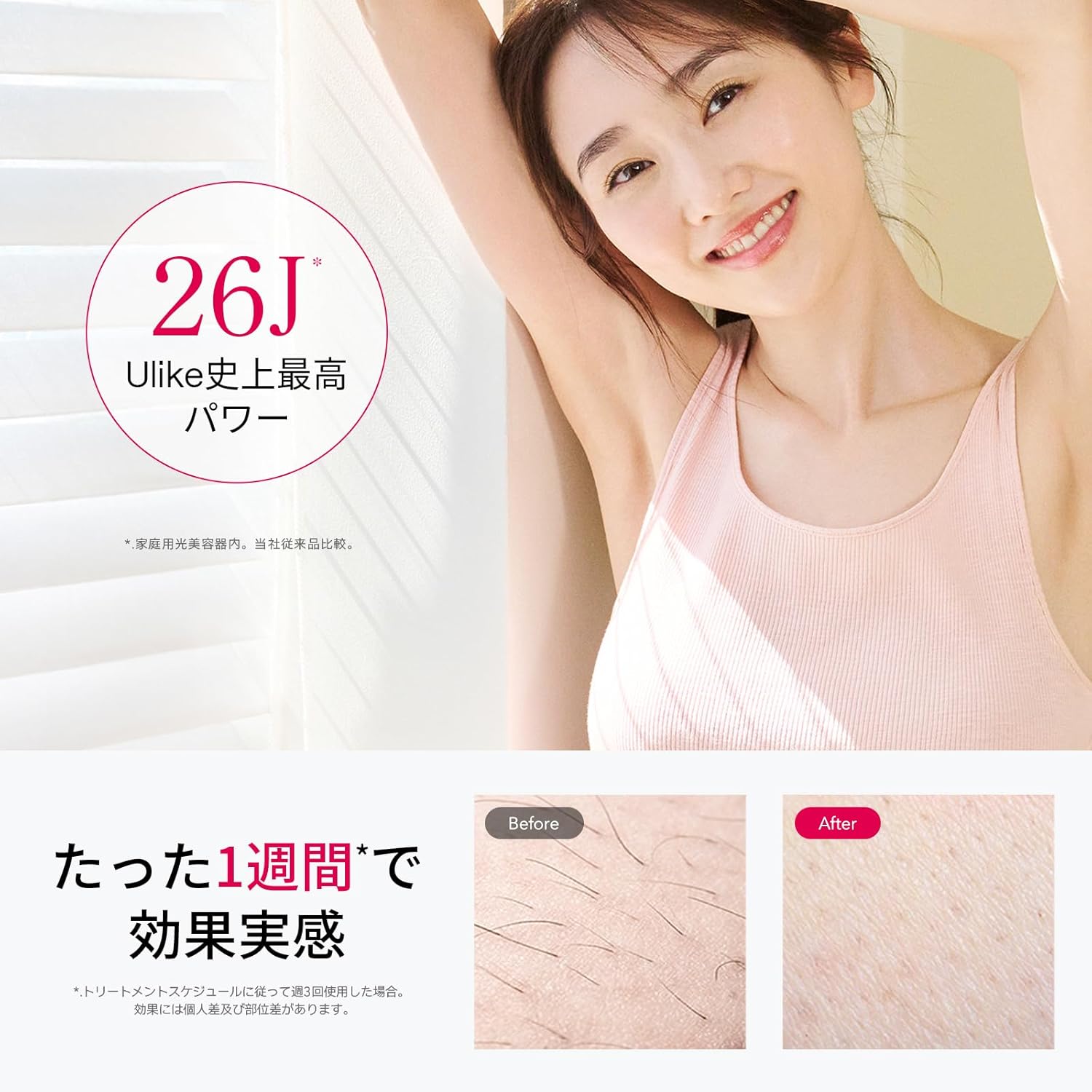 家庭用光脱毛器【Ulike Air10】全身対応・無痛サファイア冷却技術・メンズ・レディース