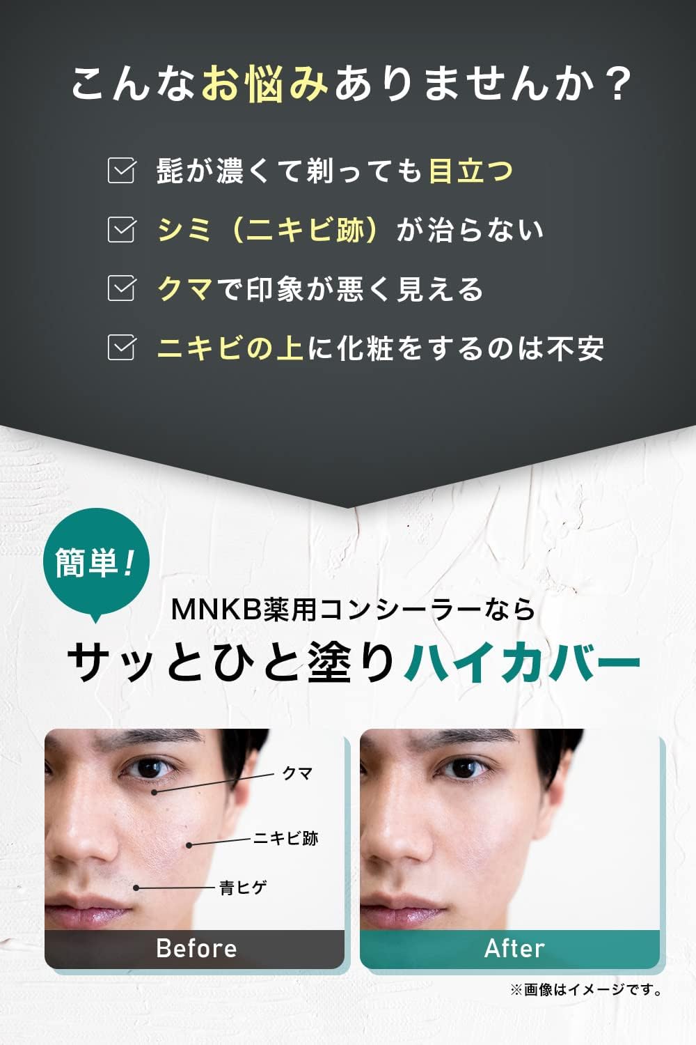 ニキビ隠しコンシーラー BBクリーム 医薬部外品 ナチュラル 2種の有効成分