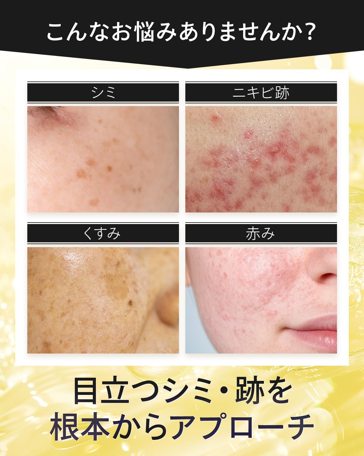 美白クリーム シミ取り 医薬部外品 ハイドロキノン＆ビタミンC 27g
