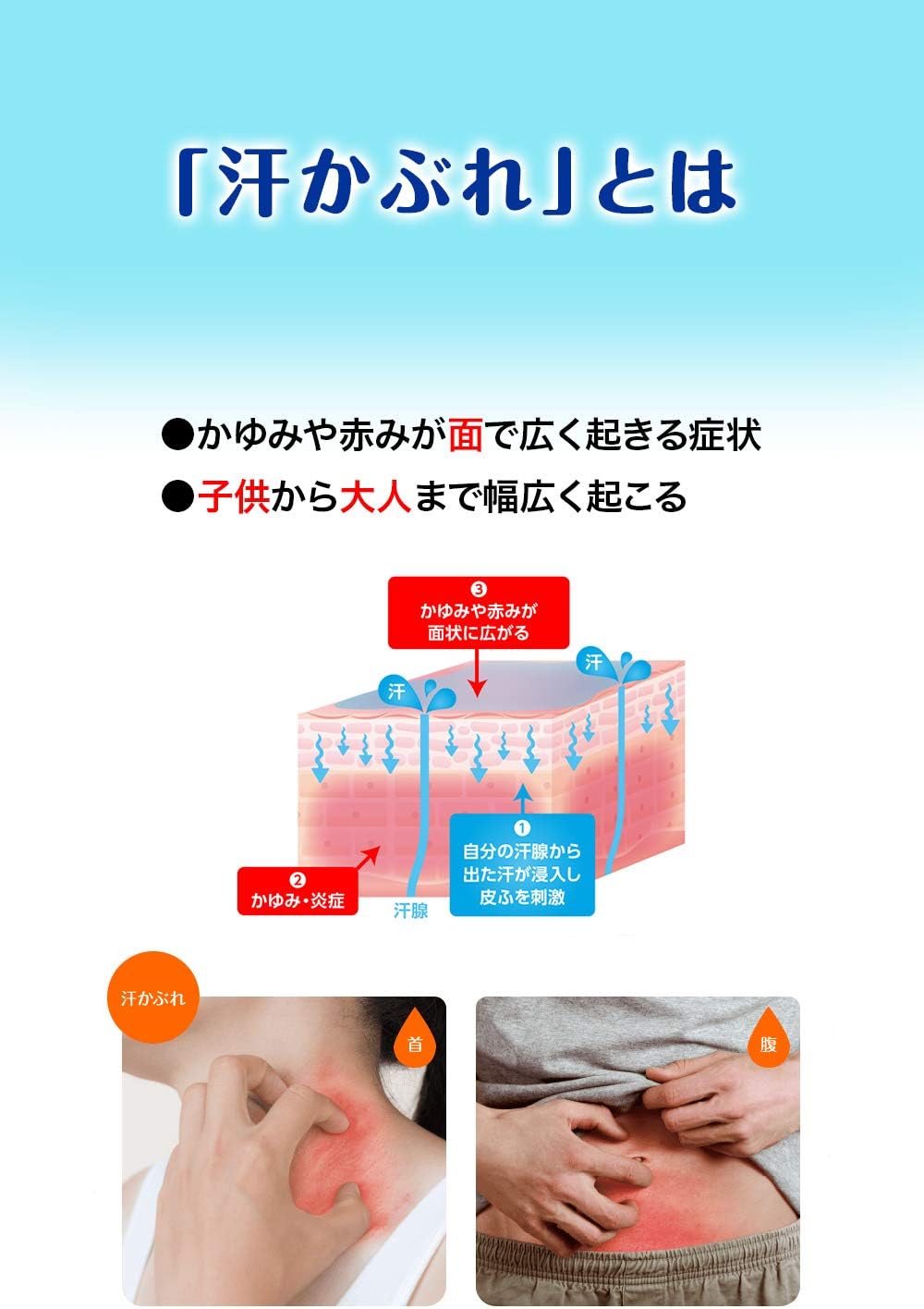アセムヒEX 15g 【指定第2類医薬品】