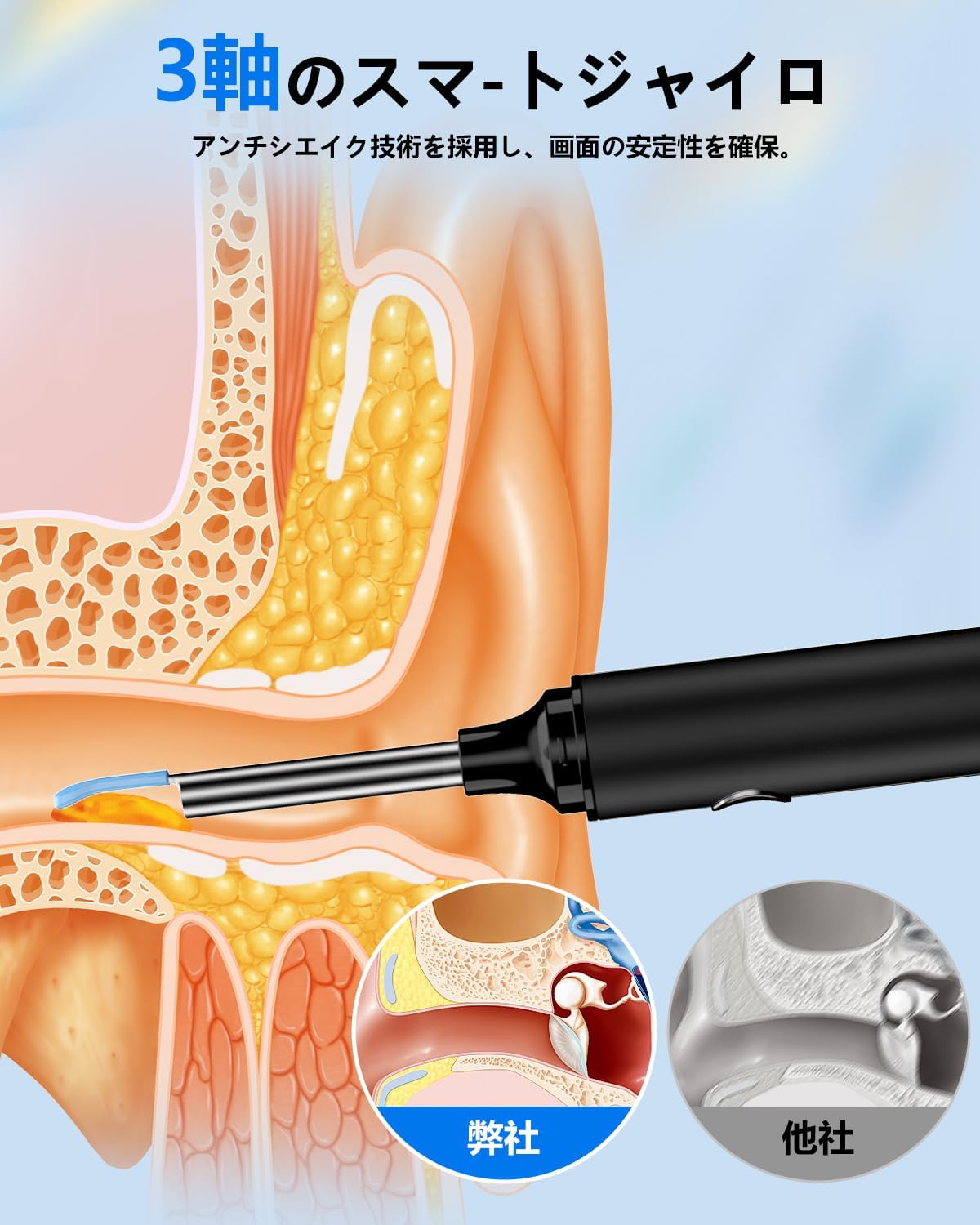 耳かきカメラ【2025年改良版・2000万画素】防水・WIFI接続・Type-C充電対応