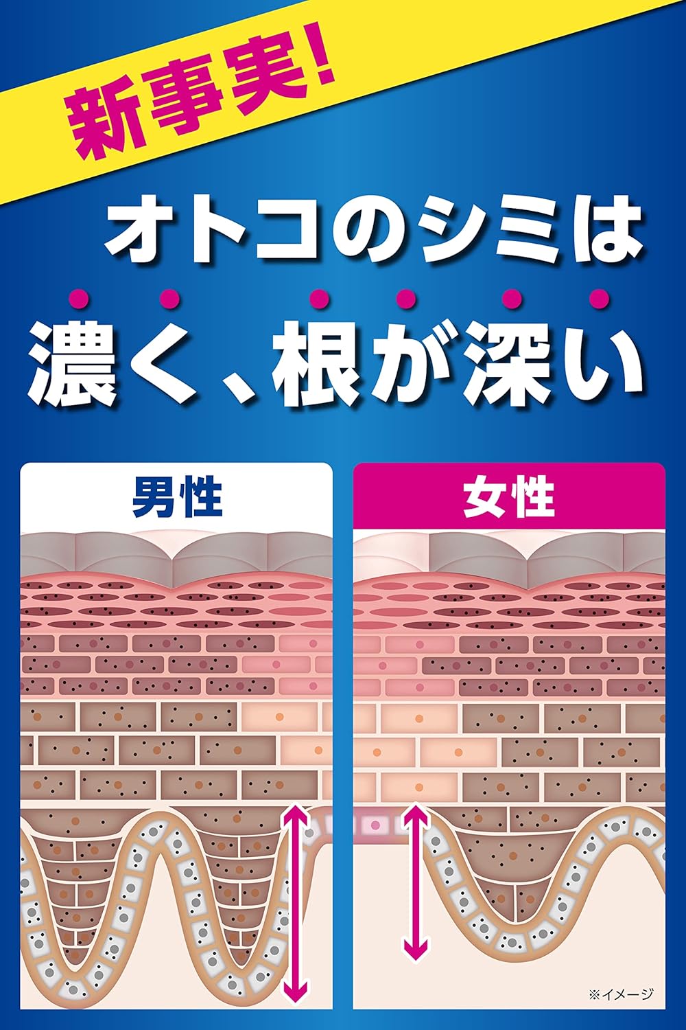 メンズケシミン乳液 100ml - シミ・そばかす対策トラネキサム酸配合