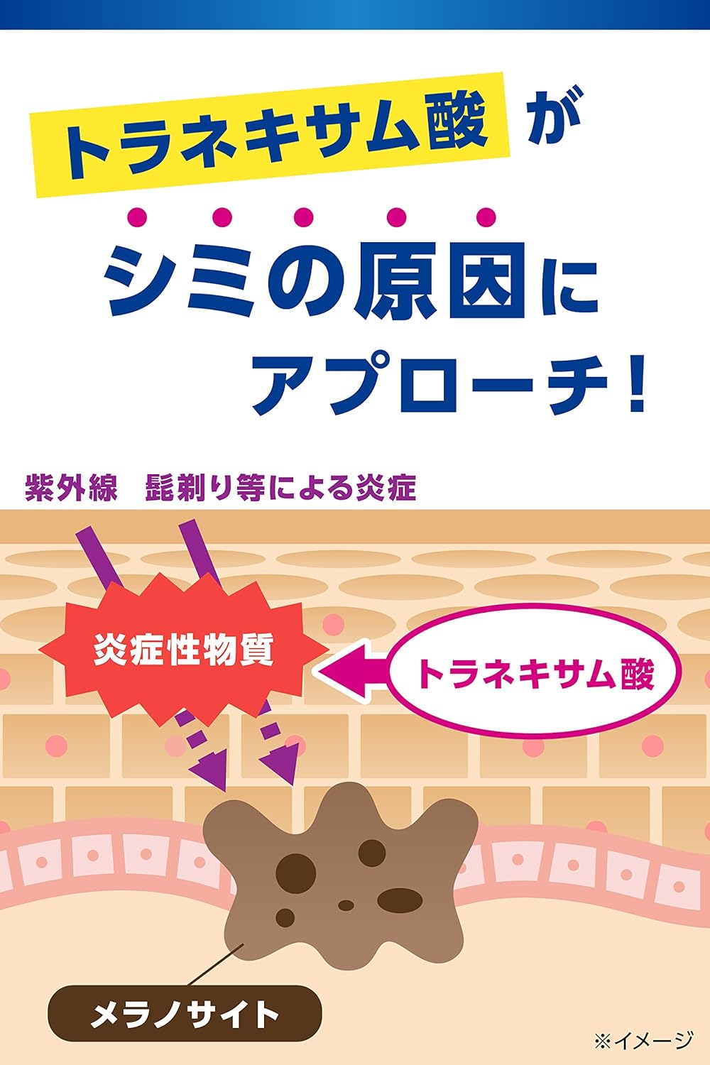 メンズケシミン乳液 100ml - シミ・そばかす対策トラネキサム酸配合
