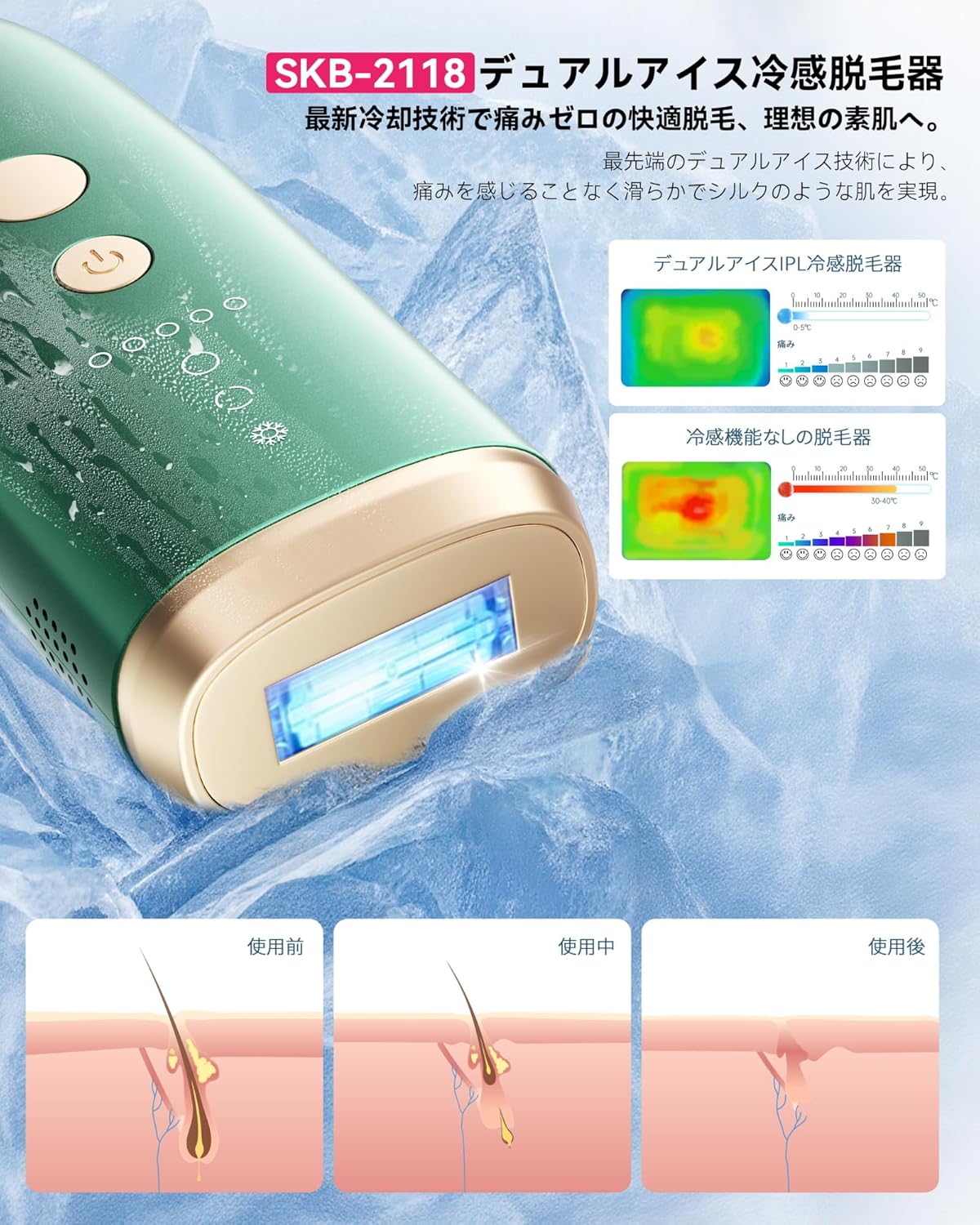 家庭用冷感無痛IPL脱毛器 レディース・メンズ用 99万回照射 VIO対応 5段階調節 デュアルアイス冷却 SKB-2118