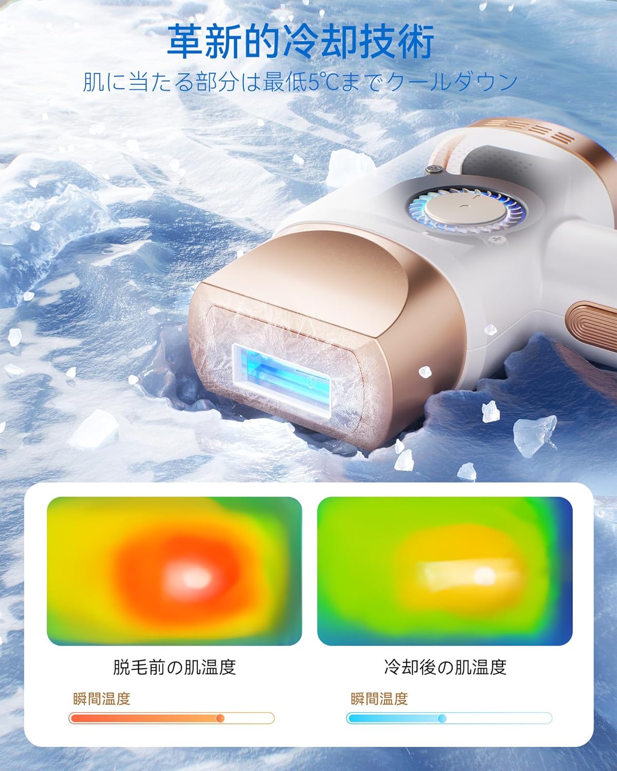 誕生日プレゼントにおすすめのYUNDOO冷感IPL脱毛器 メンズ・レディース用 99万発・9段階調節・全身対応 FZ-608G