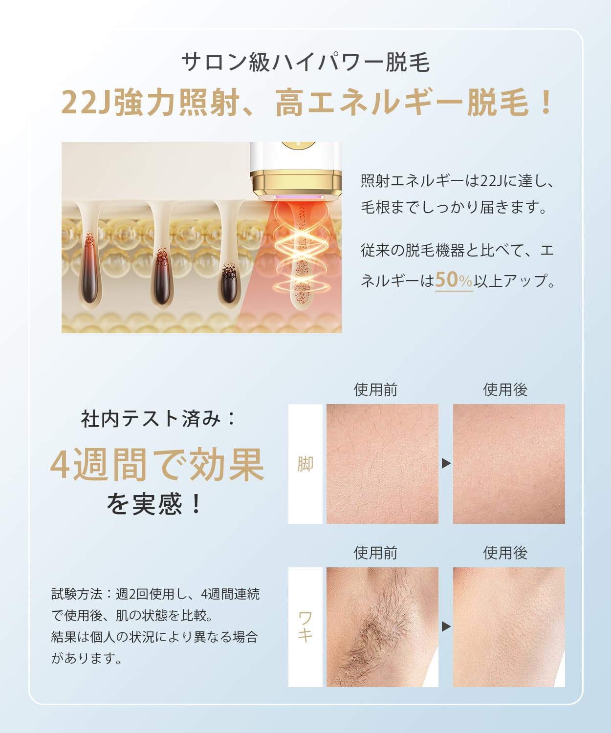 VIO対応家庭用脱毛器【2025年夏新モデル・IPL技術・99万回照射・手動/自動切替】男女兼用ハンドヘルド脱毛器