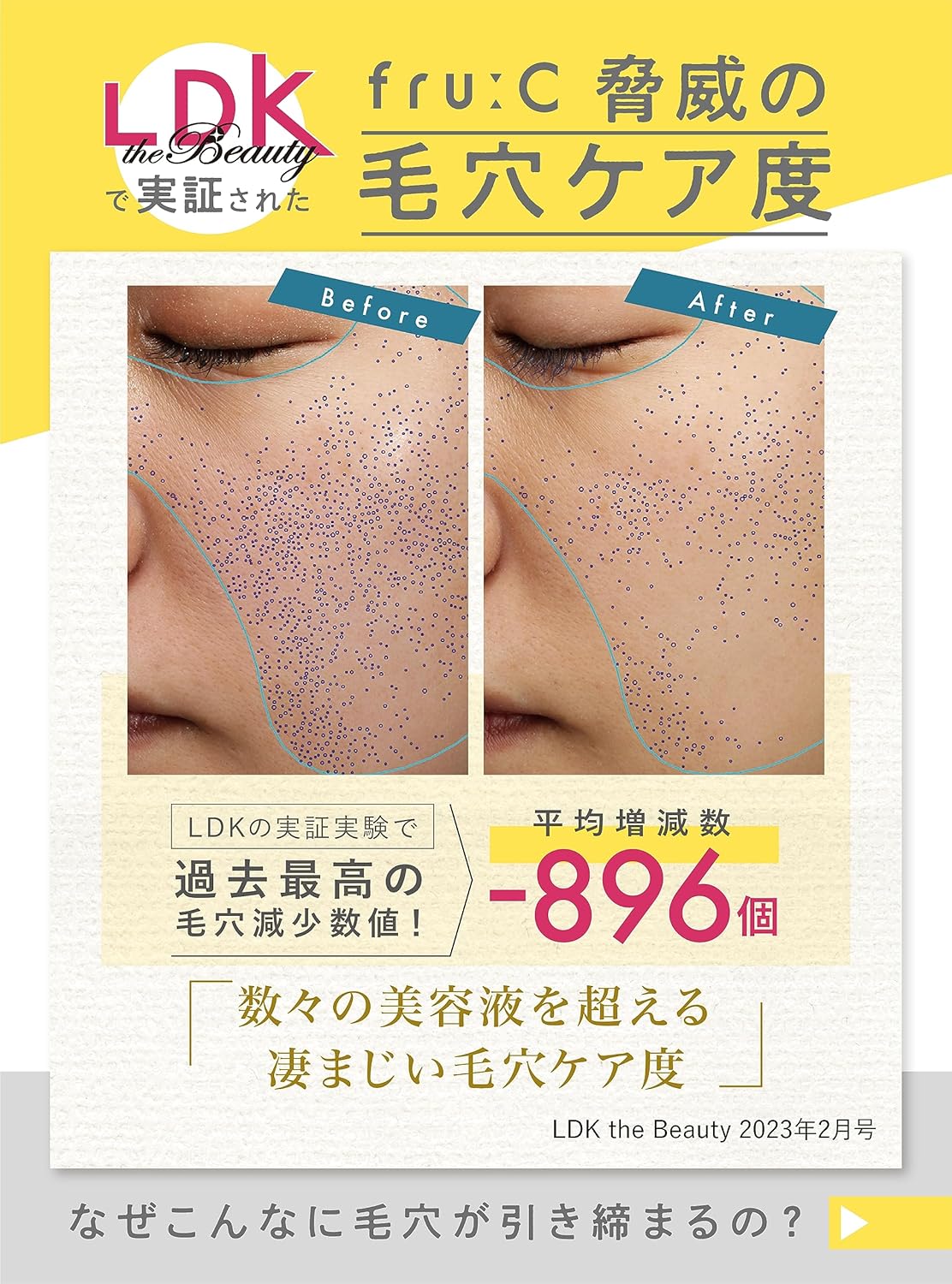 ビタミンC美容液 ホワイトCカプセル 【毛穴レス効果】 透明感アップ 75ml