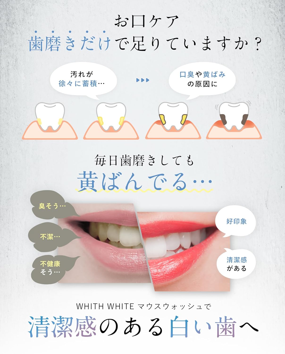 フィスホワイト ホワイトニング マウスウォッシュ 低刺激 300ml 口臭ケア
