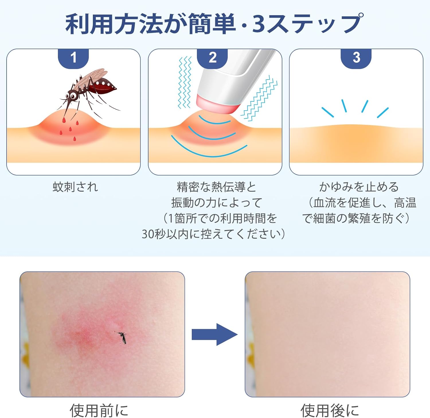 家族用 蚊虫対策器 - 4段調温、振動×熱、充電式、肌に優しい安全無毒タイプ