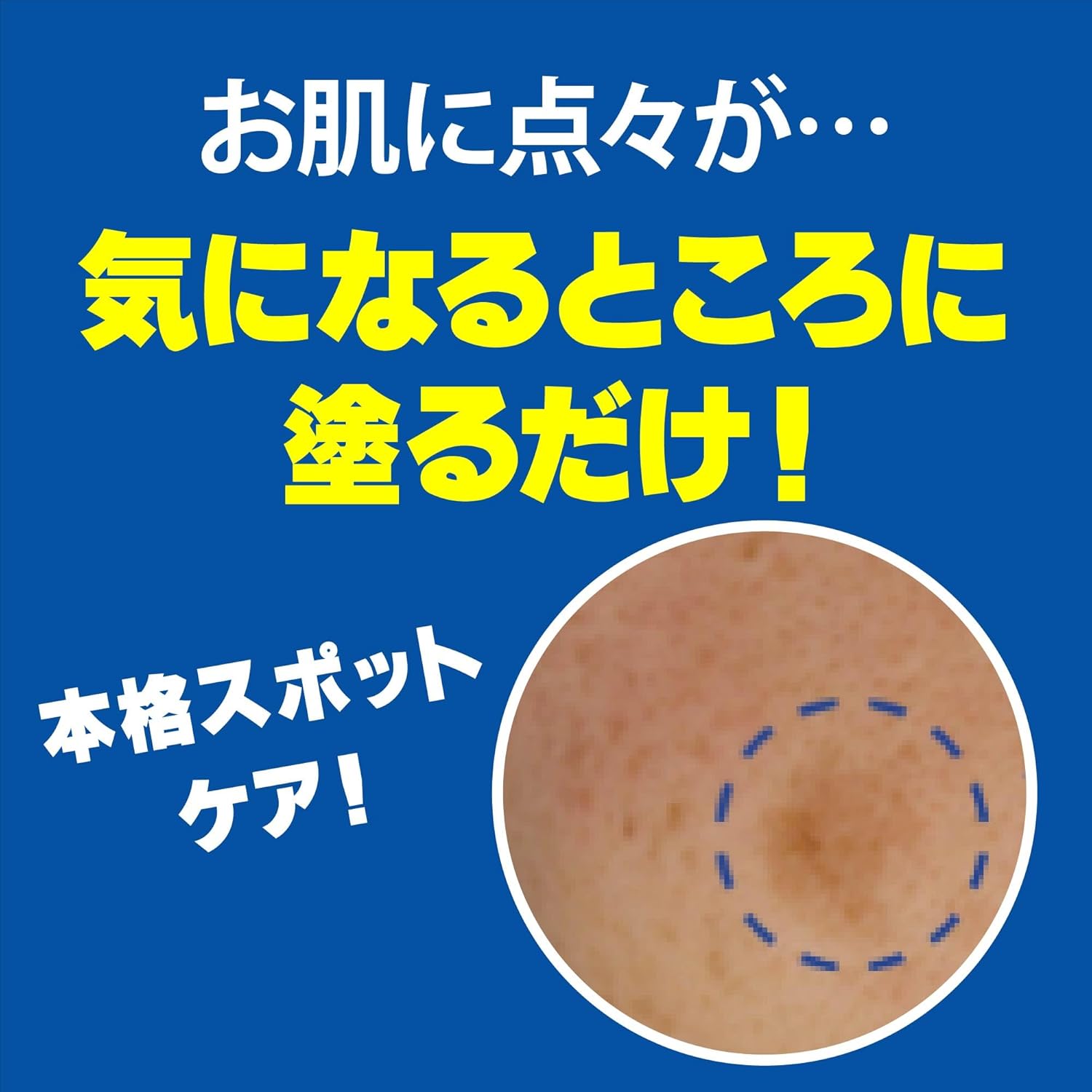 業務用ハイドロキノン5%クリーム 15g 医師管理用