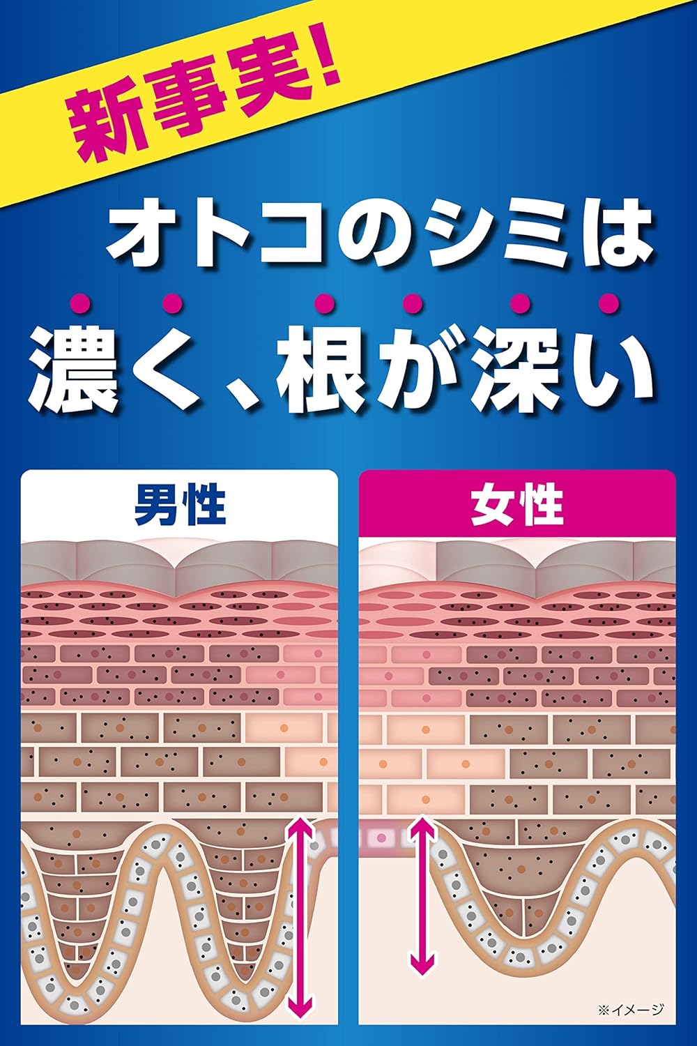 メンズシミ対策クリーム（トラネキサム酸配合）20g