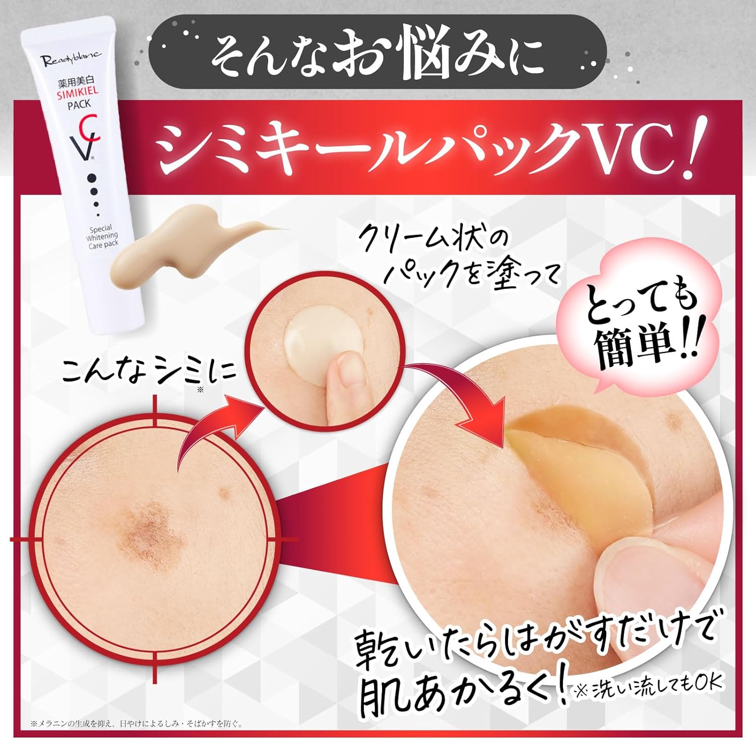 シミ集中ケア ビタミンC美白クリーム（30g）