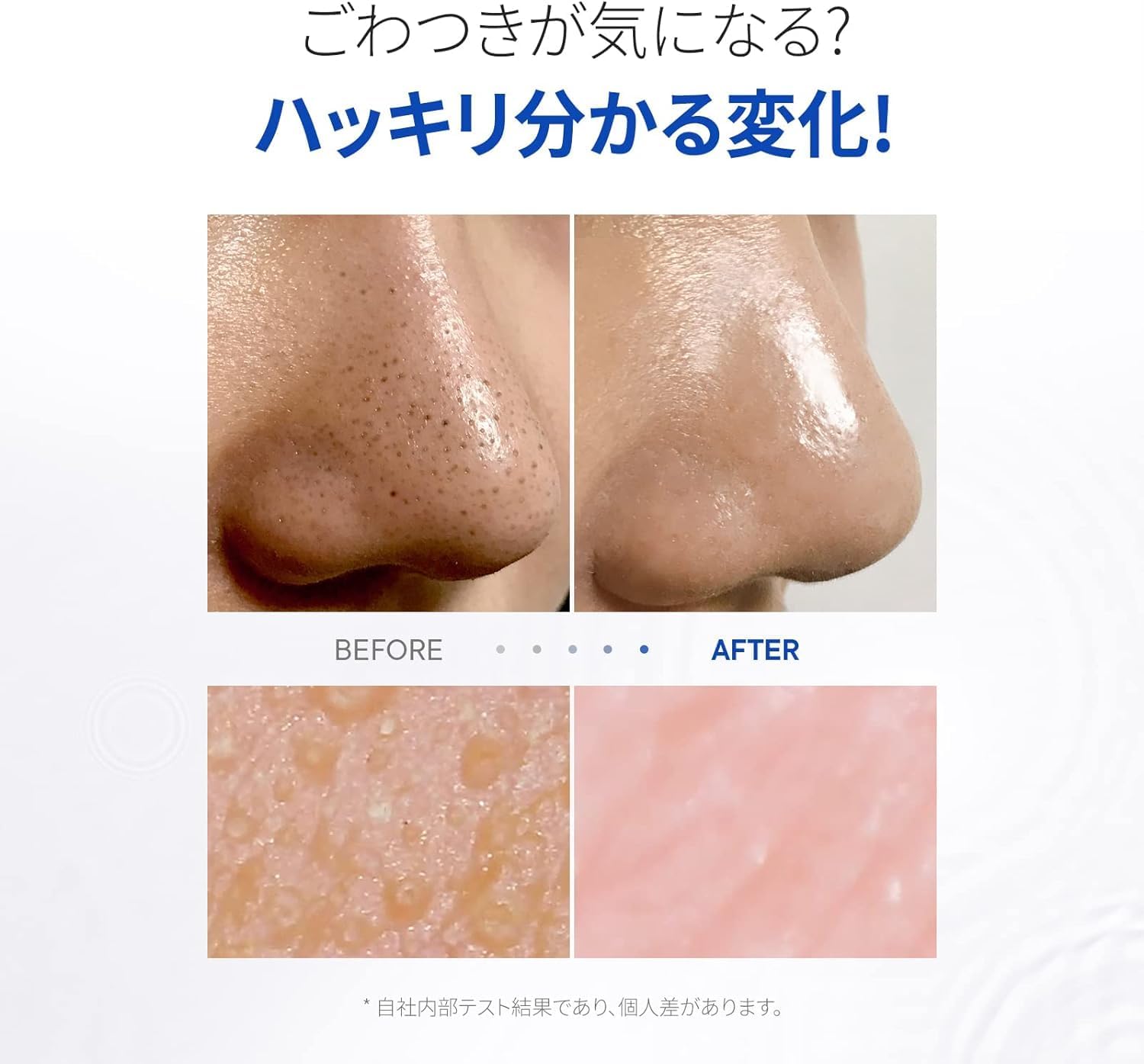 ノーモアブラックヘッド除去ポアクリーンデュオ100ml【皮脂ケア・黒ずみ対策】
