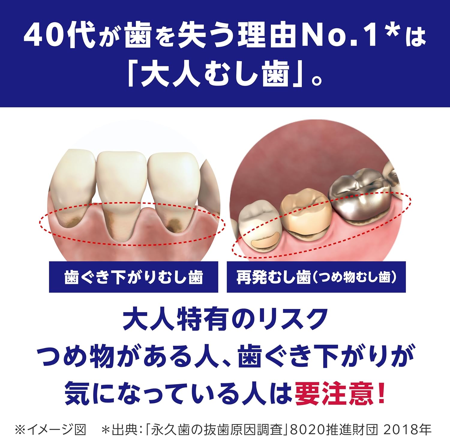 エフペースト α 歯磨き粉 1450ppmフッ素配合 むし歯・歯周病予防 90g