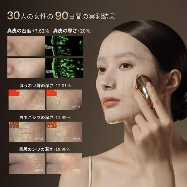 自宅エステ用 AMIRO スタンプ式 RF美顔器 EMS ひきしめ リフトケア ゴールド調 S1