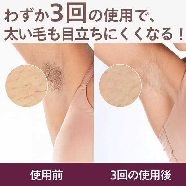 フィリップス ルメア 8000 光美容器 レディース・メンズ用 VIライン・全身アタッチメント付 パールピンク
