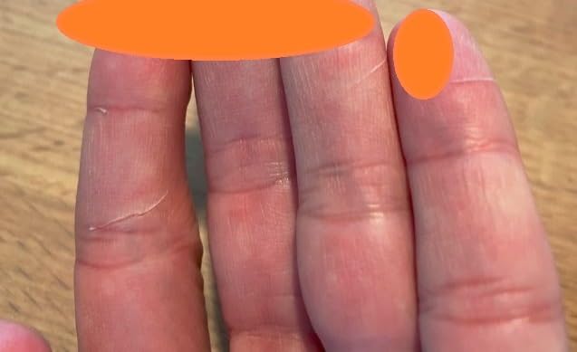 ベルモント ストリンガーセット 5点セット